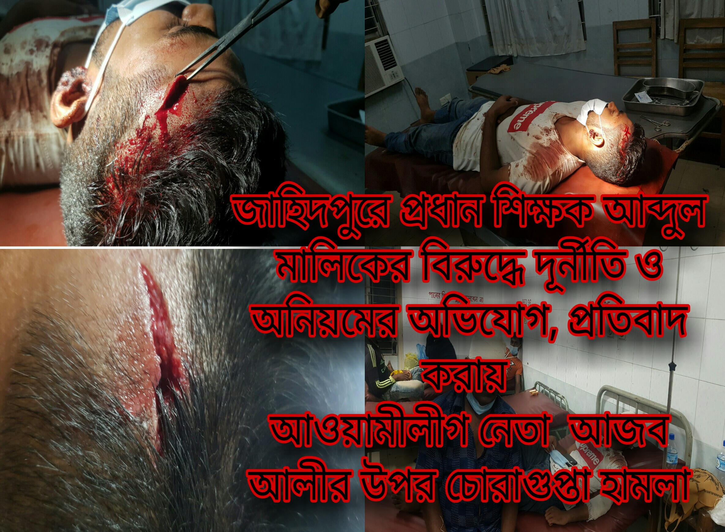 বিদ্যালয়ে প্রধান শিক্ষক আব্দুল মালিকের বিরুদ্ধে দূর্নীতি ও অনিয়মের অভিযোগ, প্রতিবাদ করায় আওয়ামীলীগ নেতা  আজব আলীর উপর চোরাগুপ্তা হামলা