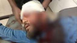 এন্সিপির আরেক নেতাকে গুলিবিদ্ধ, অবস্থা গুরুতর ।